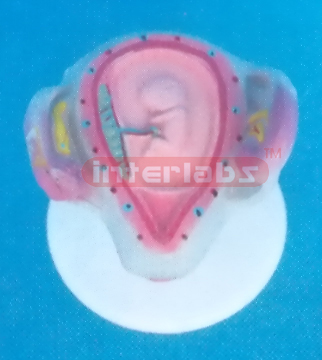 UTERUS WITH EMBRYO (2 MONTH)